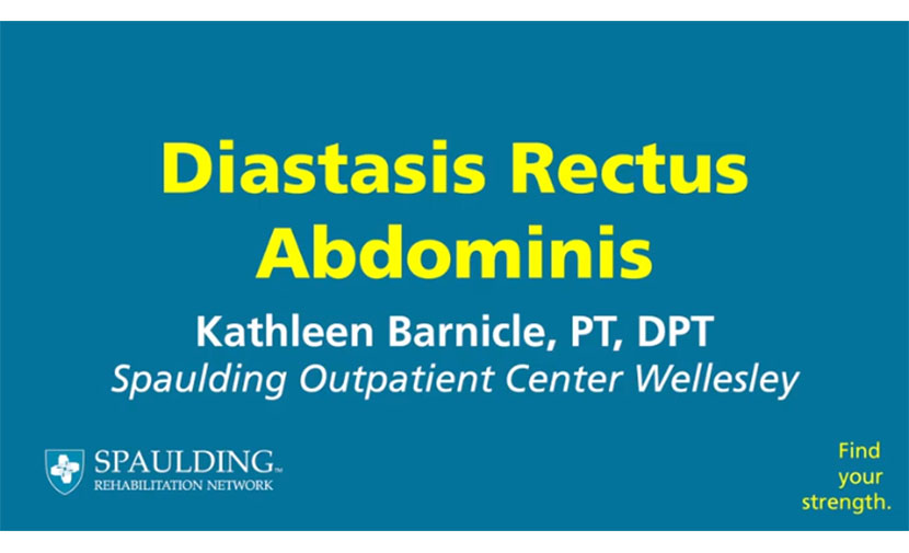 Video: Diastasis Rectus Abdominis (DRA)