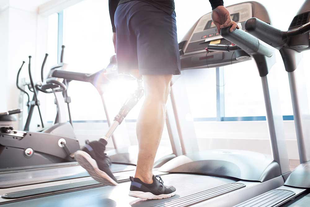 A man with one prosthetic leg running on a treadmill.