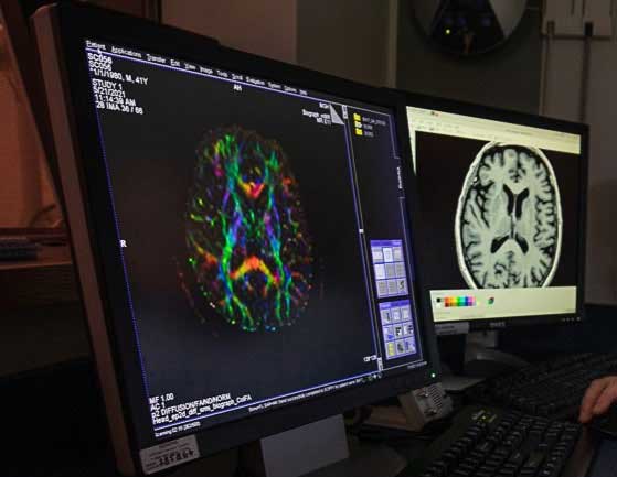 Monitors displaying two types of brain scans.