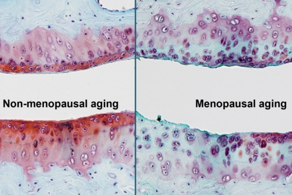 microscopic image of aging cells