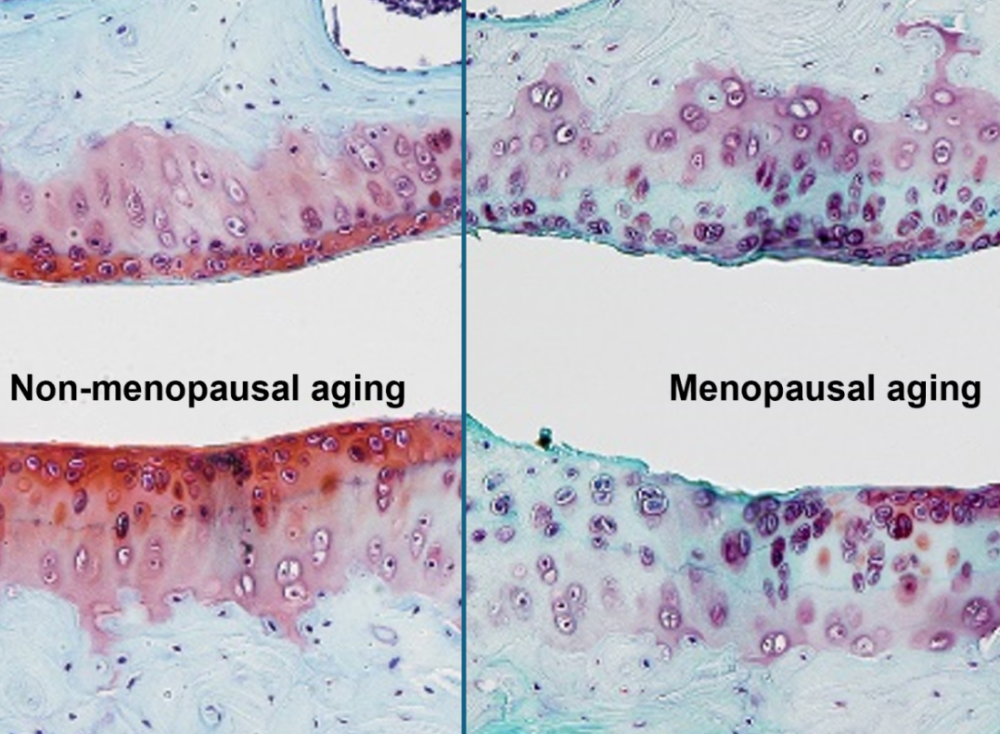 aging and Osteoarthritis microscopic image