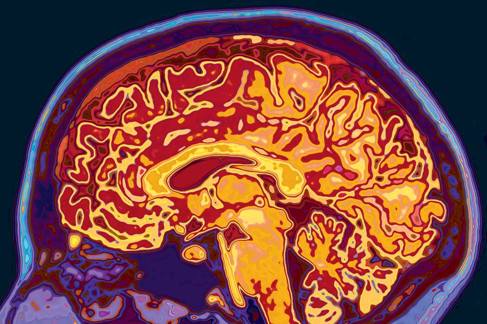 Brightly colored brain scan