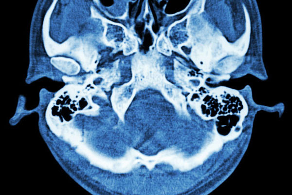 Medical scan of a skull.